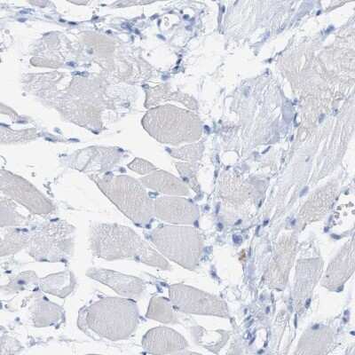 Immunohistochemistry-Paraffin: Plastin L Antibody [NBP1-88057] - Staining of human skeletal muscle shows low expression as expected.