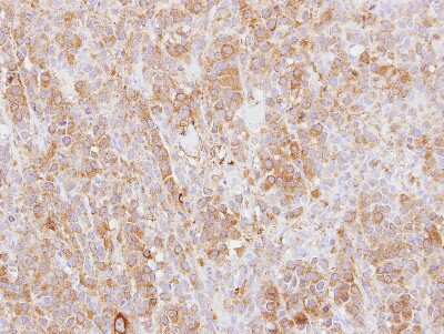 Immunohistochemistry-Paraffin: Plastin L Antibody [NBP2-19861] - Immunohistochemical analysis of paraffin-embedded HBL435 xenograft, using antibody at 1:500 dilution.