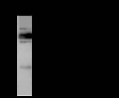 Immunoprecipitation: Plastin L Antibody [NBP2-99366] - Plastin L was immunoprecipitated using: Lane A: 0.5 mg mouse lung tissue Lysate 4 ul anti-Plastin L rabbit polyclonal antibody and 60 ug of Immunomagnetic beads. Protein A/G. Primary antibody: Anti-Plastin L rabbit polyclonal antibody, at 1:100 dilution. Secondary antibody: Goat Anti-Rabbit IgG (H+L)/HRP at 1/10000 dilution. Developed using the ECL technique. Performed under reducing conditions. Predicted band size: 32 kDa. Observed band size: 30 kDa