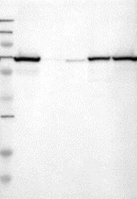 Western Blot: Plastin L Antibody [29840002] - Samples: Lane 1, Marker [kDa]: 250, 130, 95, 72, 55, 36, 28, 17, 11  Lane 2, RT-4  Lane 3, U-251MG sp  Lane 4, Human Plasma  Lane 5, Liver Lane 6, Tonsil , Target weight [kDa]:   70  Validation score: 1   Validation description: Supportive - Single band corresponding to the predicted size in kDa (+/-20%).
