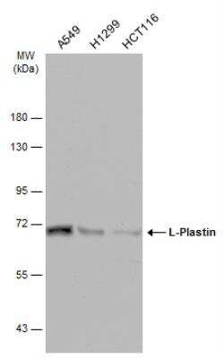 Western Blot: Plastin L Antibody [NBP2-19860] - Various whole cell extracts (30 ug) were separated by 7.5% SDS-PAGE, and the membrane was blotted with Plastin L antibody diluted at 1:10000. HRP-conjugated anti-rabbit IgG antibody was used to detect the primary antibody.