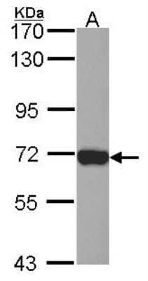 Western Blot: Plastin L Antibody [NBP2-19861] - Sample (30 ug of whole cell lysate) A: JurKat 7. 5% SDS PAGE gel, diluted at 1:1000.