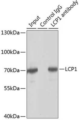 Western Blot: Plastin L Antibody [NBP2-94267] - Analysis of 150ug extracts of Jurkat cells using Plastin L at a dilition of 1:1000.