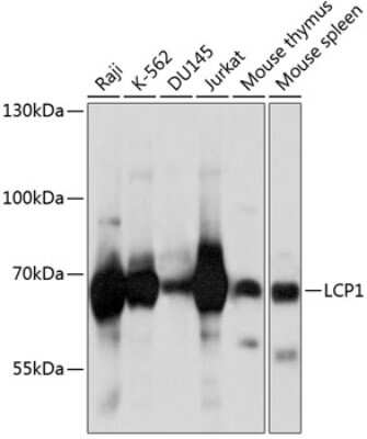 Western Blot: Plastin L Antibody [NBP2-94267] - Analysis of extracts of various cell lines, using Plastin L at 1:1000 dilution.Secondary antibody: HRP Goat Anti-Rabbit IgG (H+L) at 1:10000 dilution.Lysates/proteins: 25ug per lane.Blocking buffer: 3% nonfat dry milk in TBST.Detection: ECL Basic Kit .Exposure time: 5s.