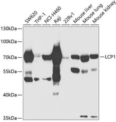 Western Blot: Plastin L Antibody [NBP2-95139] - Analysis of extracts of various cell lines, using Plastin L at 1:1000 dilution.Secondary antibody: HRP Goat Anti-Rabbit IgG (H+L) at 1:10000 dilution.Lysates/proteins: 25ug per lane.Blocking buffer: 3% nonfat dry milk in TBST.Detection: ECL Basic Kit .Exposure time: 5s.