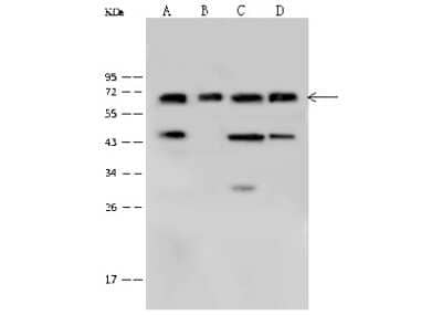 Western Blot: Plastin L Antibody [NBP2-99366] - Anti-Plastin L rabbit polyclonal antibody at 1:500 dilution. Lane A: THP1 Whole Cell Lysate Lane B: K562 Whole Cell Lysate Lane C: Jurkat Whole Cell Lysate Lane D: Daudi Whole Cell Lysate Lysates/proteins at 30 ug per lane. Secondary Goat Anti-Rabbit IgG (H+L)/HRP at 1/10000 dilution. Developed using the ECL technique. Performed under reducing conditions. Predicted band size: 70 kDa. Observed band size: 70 kDa