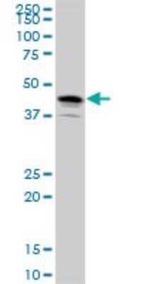 Western Blot: Pleckstrin Antibody [H00005341-B01P] - Analysis of PLEK expression in human placenta.