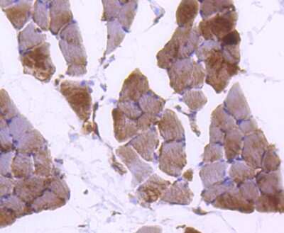 Immunohistochemistry-Paraffin: Plectin Antibody (SY29-04) [NBP2-67452] - Analysis of paraffin-embedded rat skeletal muscle tissue using anti-Plectin antibody. Counter stained with hematoxylin.