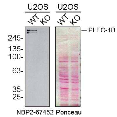 Knockout Validated: Plectin Antibody (SY29-04) [NBP2-67452] - Western blot using lysates from U20S parental cell line and Plectin-1 knockout U20S cell line (KO), collected in RIPA buffer. Nitrocellulose membrane was probed with Mouse Anti-Human/Mouse Plectin Monoclonal Antibody (Catalog # NBP2-67452) at a 1:1000 dilution O/N at 4C, followed by HRP-conjugated Anti-Mouse IgG Secondary Antibody and ECL detection. A specific band was detected for Plectin-1 (as indicated) in the parental U20S cell line, but is not detectable in knockout U20S cell line. The Ponceau stained transfers of each blot are shown to confirm equal protein loading. Image, protocol and testing courtesy of YCharOS Inc. (ycharos.com).