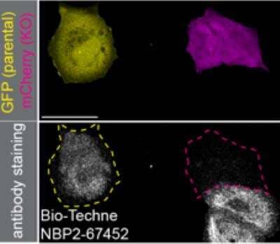 Knockout Validated: Plectin Antibody (SY29-04) [NBP2-67452] - Parental and KO cells were transfected with a GFP or mCherry plasmid, respectively. Both cell lines were mixed and plated to a 1:1 ratio on coverslips. Cells were stained with an anti-Plectin antibody and with the corresponding Alexa-fluor 647 coupled secondary antibody. Acquisition of the green (parental), red (KO) and far-red (antibody staining) channels was performed, and representative images are shown. Parental and KO cells are outlined with green and red dashed line, respectively. Grayscale images of the far-red channel are shown. Antibody dilution used: NBP2-67452 at 1/1000. Bars = 40 um. Images and testing courtesy of YCharOS Inc. (ycharos.com).  