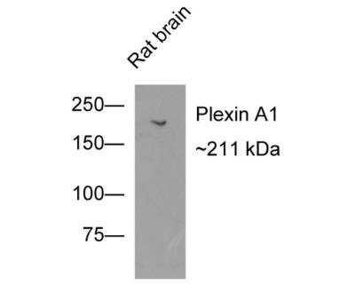 Western Blot: Plexin A1 Antibody (JU50-37) [NBP2-75623] - Analysis of Plexin A1 on rat brain tissue lysates with Rabbit anti-Plexin A1 antibody at 1/500 dilution. Lysates/proteins at 20 ug/Lane. Predicted band size: 211 kDa Observed band size: 211 kDa Exposure time: 2 minutes; 6% SDS-PAGE gel. Proteins were transferred to a PVDF membrane and blocked with 5% NFDM/TBST for 1 hour at room temperature. The primary antibody at 1/500 dilution was used in 5% NFDM/TBST at room temperature for 2 hours. Goat Anti-Rabbit IgG - HRP Secondary Antibody at 1:200,000 dilution was used for 1 hour at room temperature.