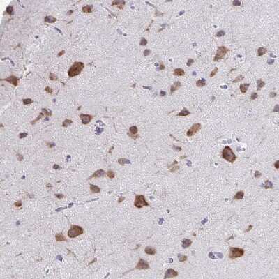 Immunohistochemistry-Paraffin: Plexin B3 Antibody [NBP2-38573] - Staining of human cerebral cortex shows strong cytoplasmic positivity in neurons.