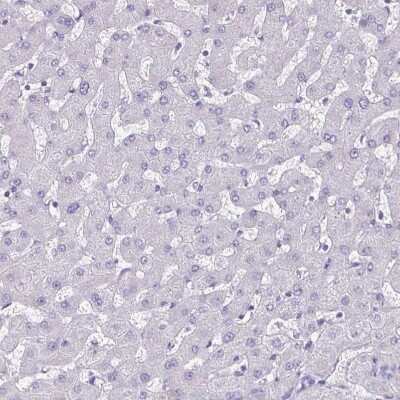 Immunohistochemistry-Paraffin: Plexin B3 Antibody [NBP2-38573] - Staining of human liver shows no positivity in hepatocytes as expected.