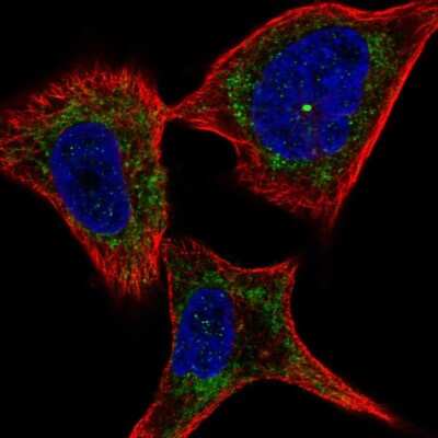 Immunocytochemistry/Immunofluorescence: Plexin C1 Antibody [NBP2-57282] - Staining of human cell line SK-MEL-30 shows localization to mitochondria.