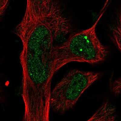 Immunocytochemistry/ Immunofluorescence Plxdc2 Antibody - BSA Free