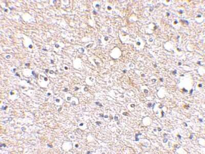 Immunohistochemistry-Paraffin: Plxdc2 Antibody [NBP1-76858] - Human brain tissue using Plxdc2 antibody at 2.5 ug/ml.