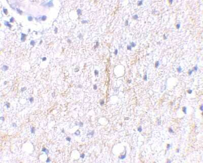 Immunohistochemistry-Paraffin: Plxdc2 Antibody [NBP1-76859] - Human brain tissue using Plxdc2 antibody at 2.5 ug/ml.