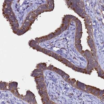 Immunohistochemistry-Paraffin: Plxdc2 Antibody [NBP1-92278] - Staining of human Fallopian tube shows strong membranous positivity in glandular cells.