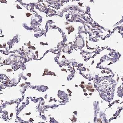 Immunohistochemistry-Paraffin: Plxdc2 Antibody [NBP1-92278] - Staining of human lung shows moderate membranous positivity in macrophages.