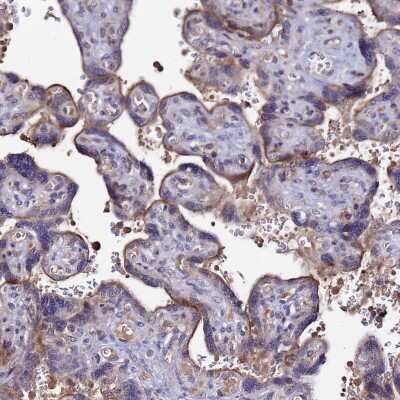 Immunohistochemistry-Paraffin: Plxdc2 Antibody [NBP1-92278] - Staining of human placenta shows moderate membranous positivity in trophoblastic cells.