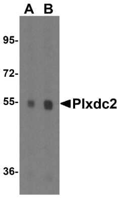 Western Blot Plxdc2 Antibody - BSA Free