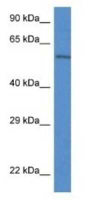 Western Blot: Plxdc2 Antibody [NBP1-79337] - Mouse Pancreas Lysate 1 ug/ml  Gel Concentration 12%