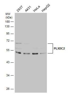 Western Blot: Plxdc2 Antibody [NBP2-19869] - Various whole cell extracts (30 ug) were separated by 10% SDS-PAGE, and the membrane was blotted with PLXDC2 antibody [N1C1] diluted at 1:1000.