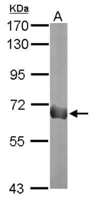 Western Blot: Podocalyxin Antibody [NBP2-19880] - Sample (20 ug of whole cell lysate) A: human ESC 7. 5% SDS PAGE gel, diluted at 1:1000.