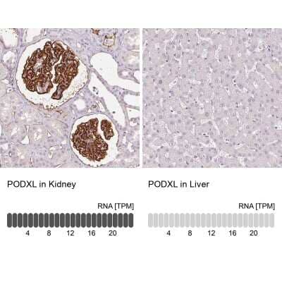 <b>Orthogonal Strategies Validation. </b>Immunohistochemistry-Paraffin: Podocalyxin Like Antibody (CL0284) [NBP2-52903] - Staining in human kidney and liver tissues. Corresponding PODXL RNA-seq data are presented for the same tissues.