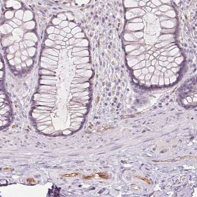 Immunohistochemistry-Paraffin: Podocalyxin Like Antibody (CL0285) [NBP2-52904] - Staining of human rectum shows moderate membranous positivity in endothelial cells.