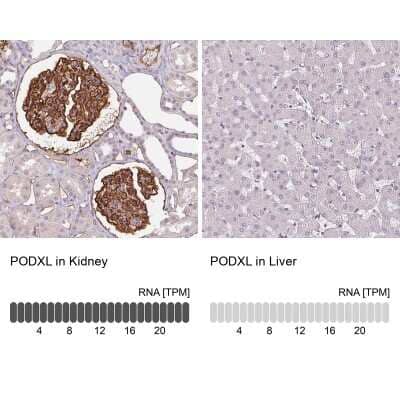 <b>Orthogonal Strategies Validation. </b>Immunohistochemistry-Paraffin: Podocalyxin Like Antibody (CL0285) [NBP2-52904] - Staining in human kidney and liver tissues. Corresponding PODXL RNA-seq data are presented for the same tissues.