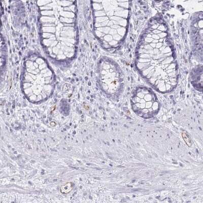 Immunohistochemistry-Paraffin: Podocalyxin Like Antibody (CL0308) [NBP2-52912] - Staining of human rectum shows weak to moderate membranous positivity in endothelial cells.