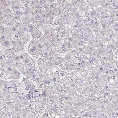 Immunohistochemistry-Paraffin: Podocalyxin Like Antibody [NBP1-83348] - Staining of human liver shows no positivity in hepatocytes as expected.