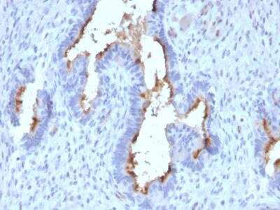 Immunohistochemistry-Paraffin: Podocalyxin Like Antibody (PODXL/2185) - Azide and BSA Free [NBP2-79884] - Formalin-fixed, paraffin-embedded human Endometrium stained with Podocalyxin Mouse Monoclonal Antibody (PODXL/2185).
