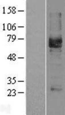 Western Blot: Podocalyxin Overexpression Lysate (Adult Normal) [NBL1-14562] Left-Empty vector transfected control cell lysate (HEK293 cell lysate); Right -Over-expression Lysate for Podocalyxin.