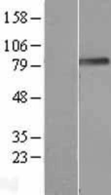 Western Blot: Podocan Overexpression Lysate (Adult Normal) [NBL1-14560] Left-Empty vector transfected control cell lysate (HEK293 cell lysate); Right -Over-expression Lysate for Podocan.
