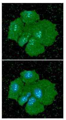 Immunocytochemistry/Immunofluorescence: Podoplanin Antibody (56F7) [NBP2-59445] - Analysis of PDPN in Hep3B cells line, stained with DAPI (Blue) for nucleus staining and monoclonal anti-human PDPN antibody (1:100) with goat anti-mouse IgG-Alexa fluor 488 conjugate (Green).