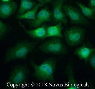 Immunocytochemistry/Immunofluorescence: Podoplanin Antibody (8.1.1) - Azide and BSA Free [NBP2-80916] - Neuro2a cells were fixed for 10 minutes using 10% formalin and then permeabilized for 5 minutes using 1X PBS + 0.05% Triton X-100. The cells were incubated with anti- at 5 ug/ml overnight at 4C and detected with an anti-Golden Syrian hamster DyLight 488 (Green) at a 1:500 dilution. Nuclei were counterstained with DAPI (Blue). Cells were imaged using a 40X objective. Image from the standard format of this antibody.