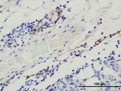 Immunohistochemistry: Podoplanin Antibody (8.1.1) - Azide and BSA Free [NBP2-80916] - Analysis of Podoplanin in mouse mammary gland after MDA-MB-231 orthotopic transplantation. Image courtesy of product review by Luana Schito. Image from the standard format of this antibody.