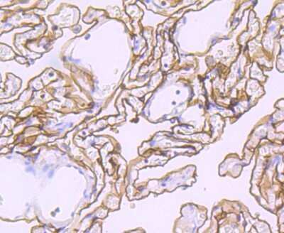 Immunohistochemistry-Paraffin: Podoplanin Antibody (JM31-21) [NBP2-67070] - Analysis of paraffin-embedded human lung tissue using anti-Podoplanin antibody. Counter stained with hematoxylin.