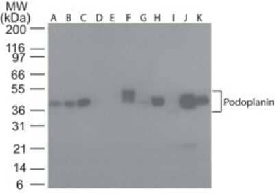 Western Blot: Podoplanin Antibody (NZ-1.2) - Azide Free [NBP2-03954] - Lysate from human A) Brain, B) Heart, C) Small Intestine, D) Kidney, E) Liver, F) Lung, G) Muscle, H) Stomach, I) Spleen, J) Ovary, and K) Testis probed with podoplanin antibody at 5 ug/ml. human tissue Insta-blot , goat anti-rat Ig HRP secondary antibody and PicoTect ECL substrate solution were used for this test.