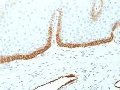 Immunohistochemistry-Paraffin: Podoplanin Antibody (PDPN/1433) - Azide and BSA Free [NBP2-54347] - Formalin-fixed, paraffin-embedded human Cervix stained with Podoplanin Monoclonal Antibody (PDPN/1433)