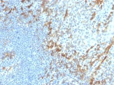 Immunohistochemistry-Paraffin: Podoplanin Antibody (PDPN/4009R) [NBP3-07494] - Formalin-fixed, paraffin-embedded human tonsil stained with Podoplanin Recombinant Rabbit Monoclonal Antibody (PDPN/4009R).