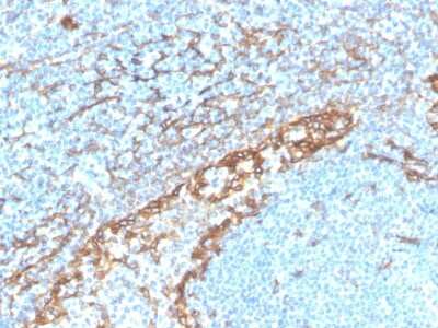 Immunohistochemistry-Paraffin: Podoplanin Antibody (PDPN/4009R) [NBP3-07494] - Formalin-fixed, paraffin-embedded human tonsil stained with Podoplanin Recombinant Rabbit Monoclonal Antibody (PDPN/4009R).