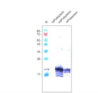 Western Blot: Podoplanin Antibody (RTD4E10) [NBP2-36058] - Analysis with recombinant human, mouse and ratsoluble Podoplanin. There is no cross reaction with human Podoplanin.