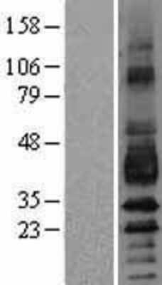 Western Blot: Podoplanin Overexpression Lysate (Adult Normal) [NBP2-04312] Left-Empty vector transfected control cell lysate (HEK293 cell lysate); Right -Over-expression Lysate for Podoplanin.