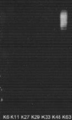 Western Blot: Poly-Ubiquitin Antibody (HWA4C4) - K63 Linkage [NBP2-36523] - Poly-Ubiquitin K63 Linkage Antibody (HWA4C4) [NBP2-36523] - Analysis at 1:1000 dilution