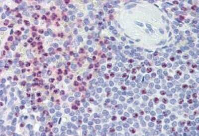 Immunohistochemistry-Paraffin: Polycystin-1/PKD1 Antibody [NBP1-52552] - Analysis of anti-PKD1 antibody with human spleen at concentration 3.75 ug/ml.