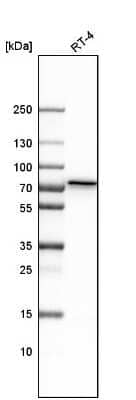 Western Blot: Polypeptide GalNac Transferase 1/GALNT1 Antibody [NBP1-81852] - Analysis in human cell line RT-4.