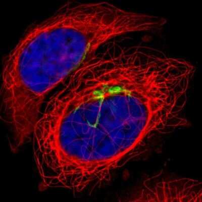 <b>Orthogonal Strategies Validation. </b>Immunocytochemistry/Immunofluorescence: Polypeptide GalNac Transferase 3/GALNT3 Antibody [NBP1-81849] - Staining of human cell line A-431 shows localization to the Golgi apparatus. Antibody staining is shown in green.